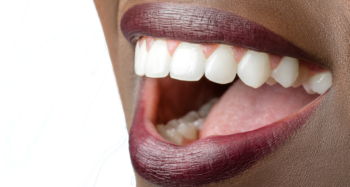 Dentes brancos: 4 dicas para mantê-los