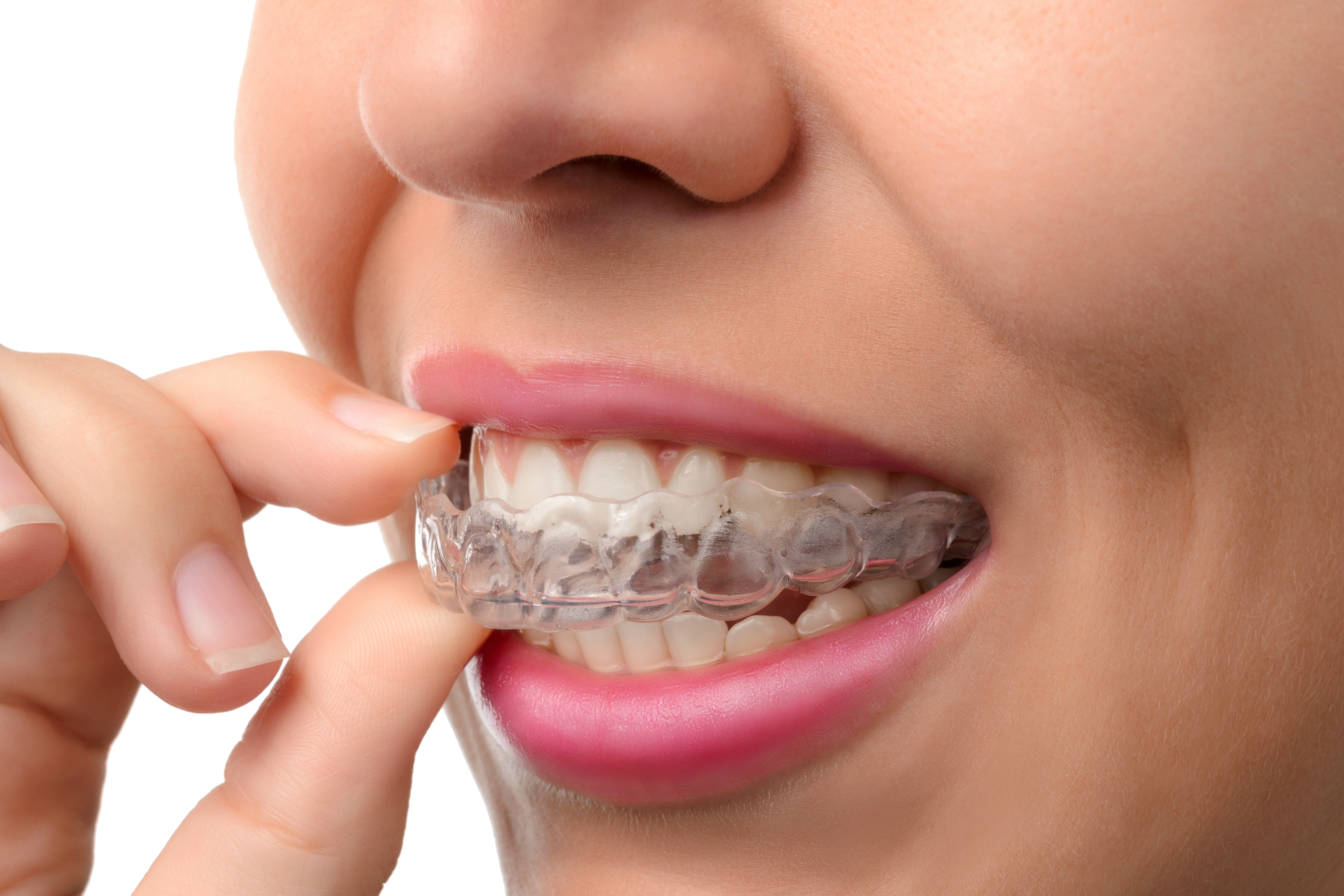 O que é Ortodontia?