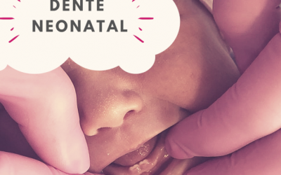 Dente Neonatal