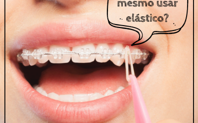 Eu preciso mesmo usar elástico?