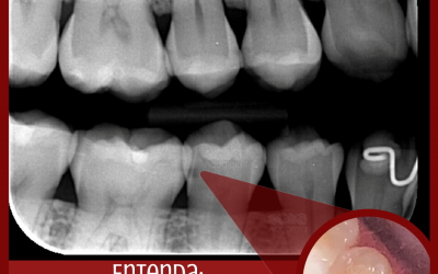 Retornos periódicos