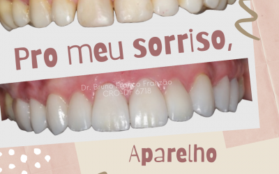 Para o meu sorriso, estética ou ortodontia?