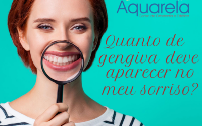 Quanto de gengiva deve aparecer no meu sorriso?