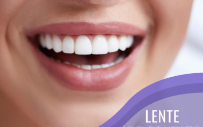 Lentes de Contato Dentais