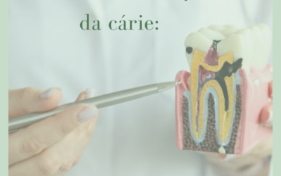 Entenda a evolução da cárie!